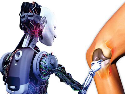 Robotic Knee Replacement in Nashik